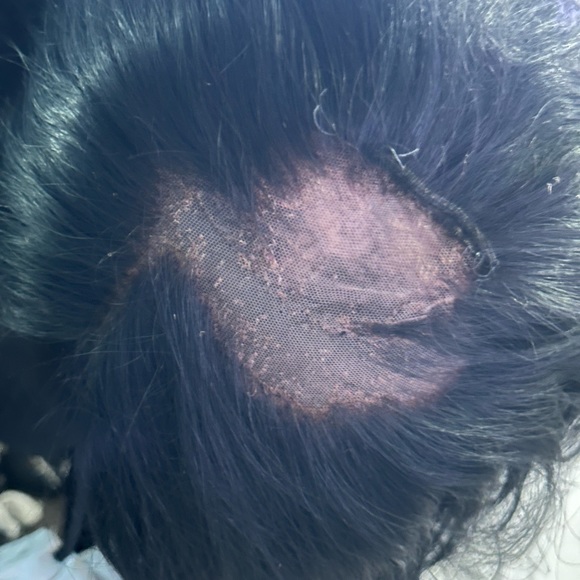 Meet your Posher, Rene - Picture 4 of 4